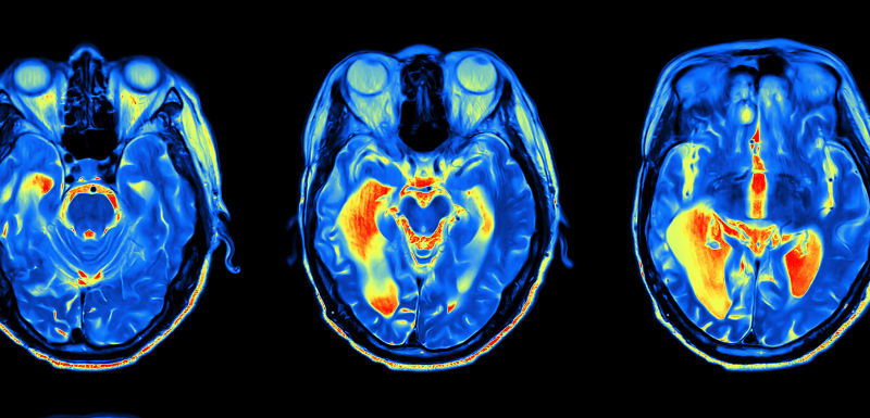 anxiete-enceinte-danger-cerveau-foetus